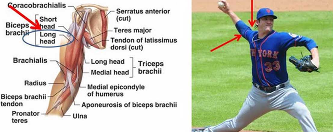 Tommy John Arm Muscles